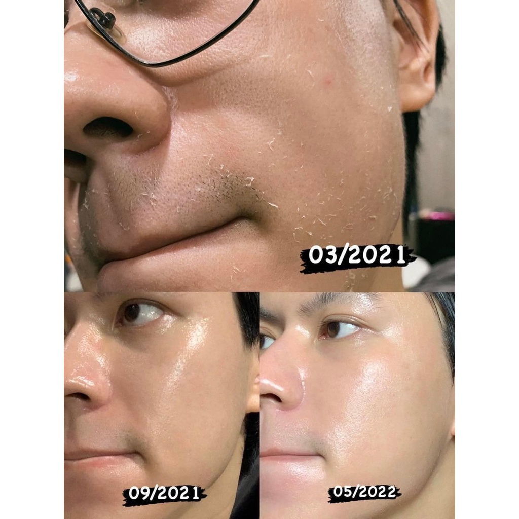 Serum dưỡng sáng da Oh!Oh! Skin Health 20% Niacinamide & 2% Acetyl Glucosamine 30ml