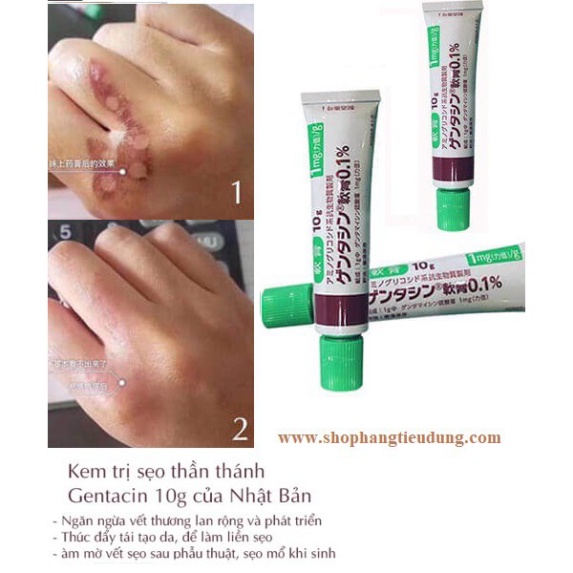 Kem Giảm Sẹo gentacin Nhật Tuýp 10g chính hãng