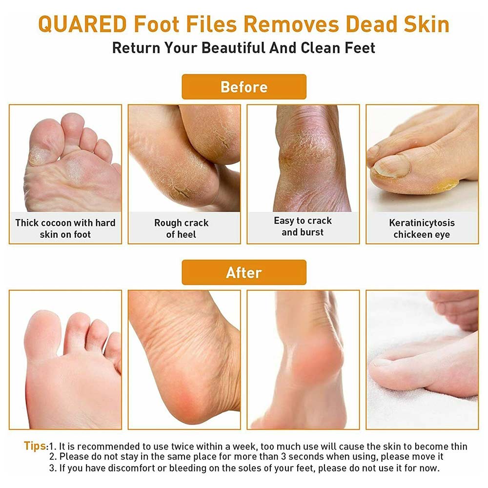 Electric vacuum cleaner foot grinder foot skin home multifunctional pedicure to remove dead skin to calluses hand and foot care