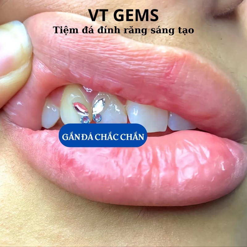 Bộ dụng cụ gắn đá răng tại nhà VTGEMS
