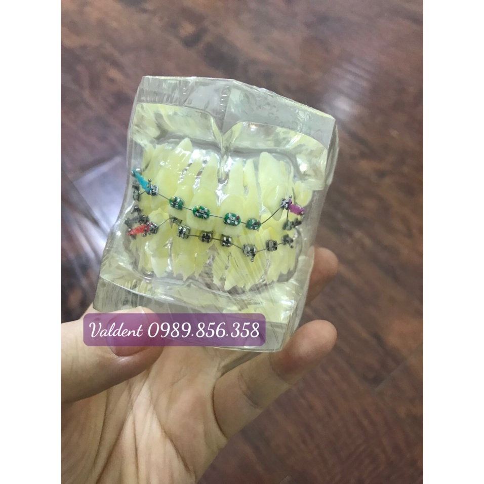 MÔ HÌNH HÀM TƯ VẤN CHỈNH NHA NHA KHOA - MÔ HÌNH TƯ VẤN NHA KHOA