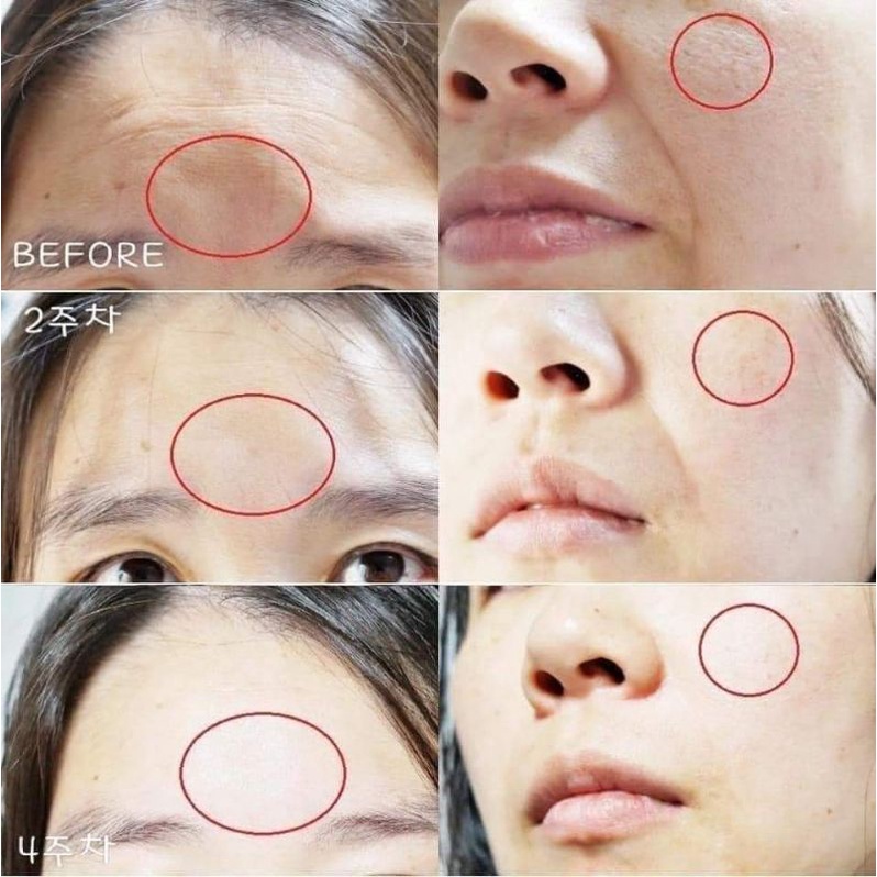 KEM DƯỠNG ILDONG MỜ NÁM SÁNG DA TỪ MEN VI SINH