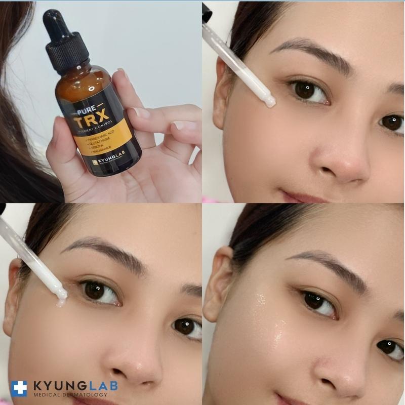 Serum trắng da, ngừa nám pure TRX Kyung Lab 30ml, loại bỏ các vết thâm mụn, nám, tàn nhang, mịn da, căng bóng da | BigBuy360 - bigbuy360.vn