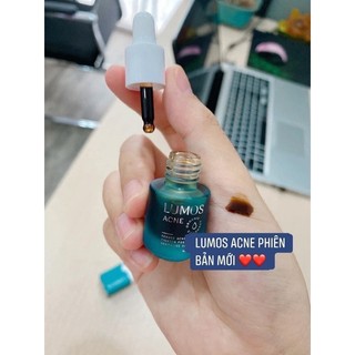 (Mẫu mới ) serum mụn Lumos hàng công ty 5ml