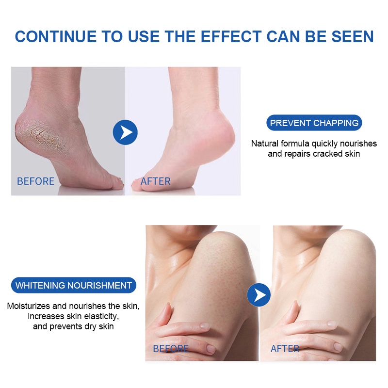 LEWEDO Vaseline Kem Dưỡng Chân Mùa Đông Gót Chân Chống Khô Dưỡng Ẩm Chống Đóng Băng Tay