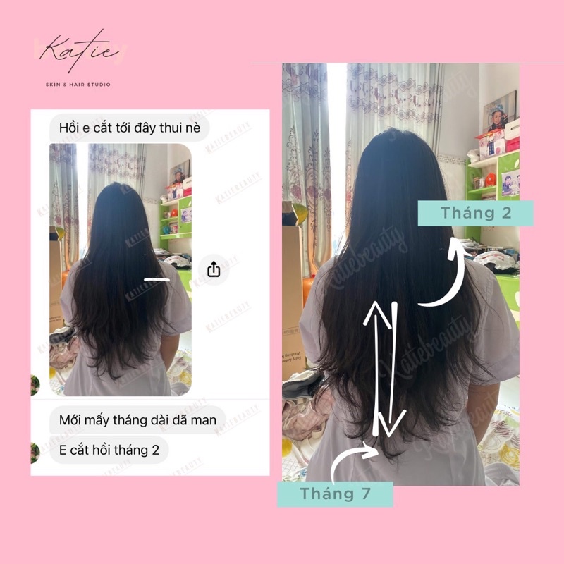 Xịt kích mọc tóc men vi sinh HAIR TREATMENT SPRAY 120ml | KATIEBEAUTY