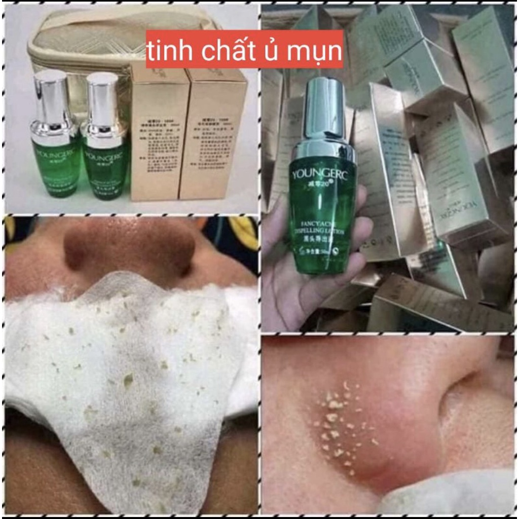 Ủ Mụn Youngerc