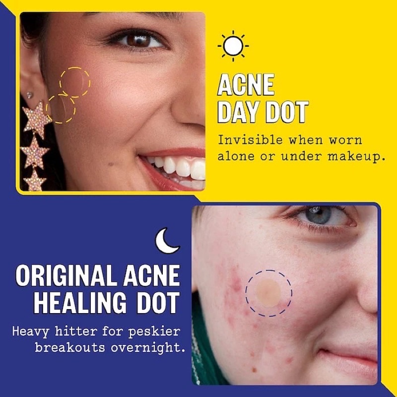 Miếng dán mụn Peace Out Acne Salicylic Acid Day & Night