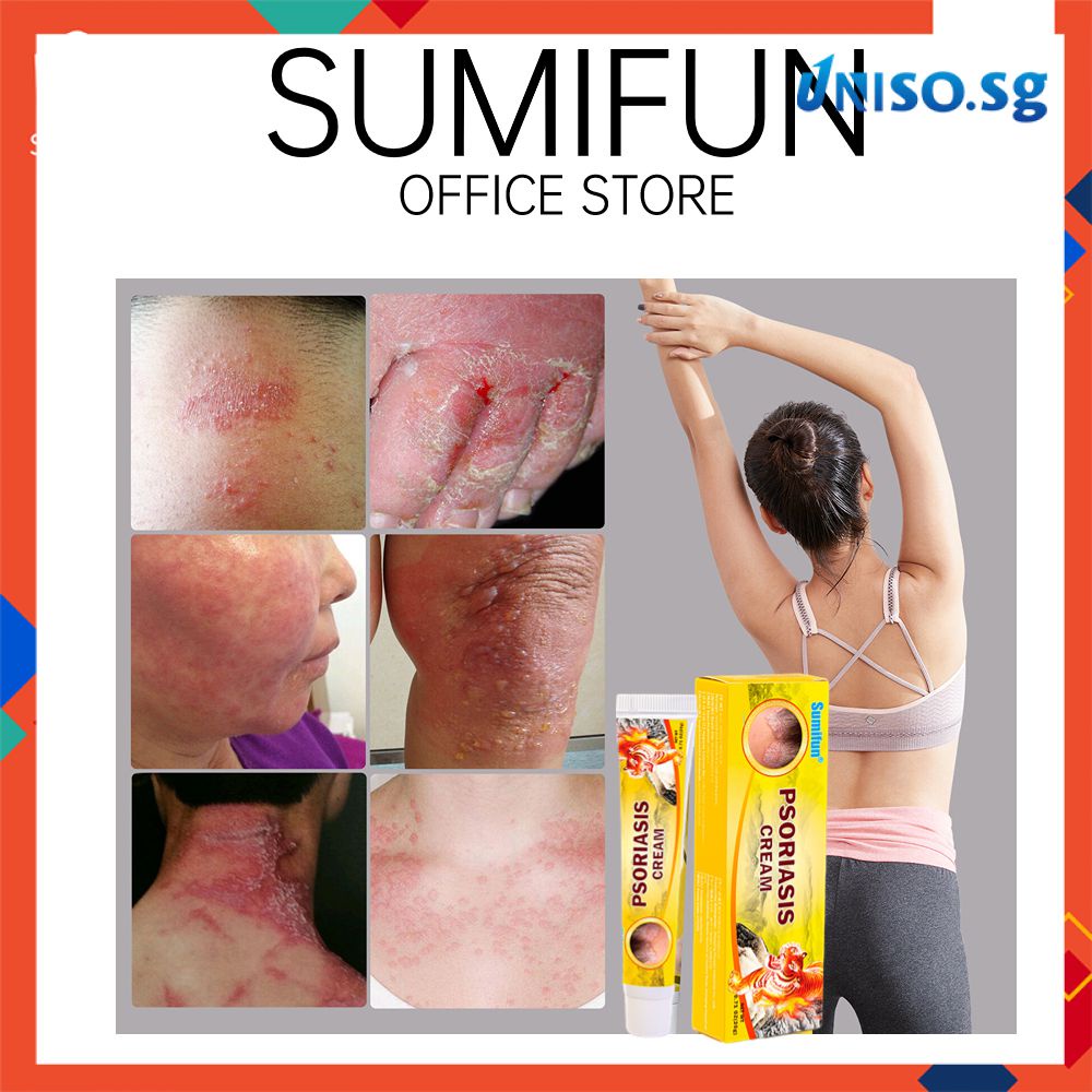 Kem Chống Ngứa 20G Thuốc Mỡ Trị Chàm, Hắc Lào, Phát Ban, Muỗi Đốt, Chiết Xuất Thực Vật, Có Thể Dùng Cho Toàn Thân [Unio]