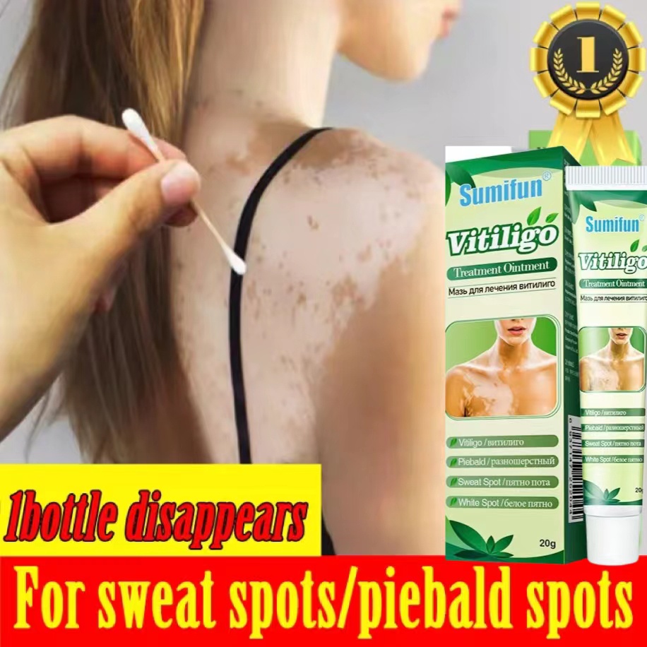 Thảo dược bôi bạch biến/20g