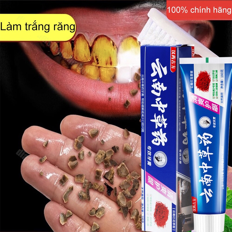 Kem Đánh Răng Làm trắng răng kem đánh răng 180g loại bỏ mảng bám trên răng nhanh chóng ố cao răng ngăn ngừa hôi miệng