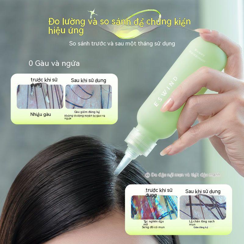 ESWIND Gel Tẩy Trang Làm Sạch Da Đầu Chống Gàu Kiểm Soát Dầu
