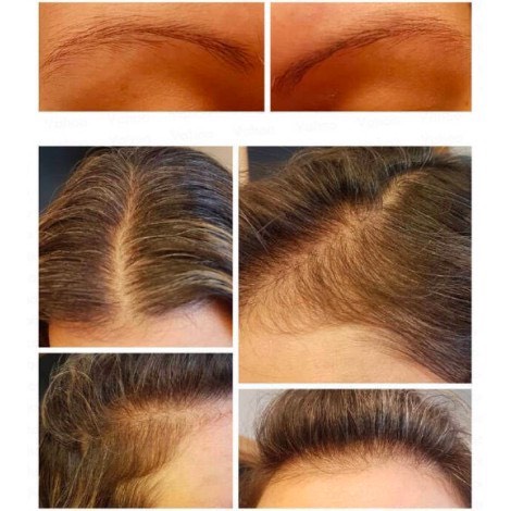 The Ordinary Serum dưỡng tóc, kích thích mọc tóc - The Ordinary Multi-Peptide Serum for Hair Density