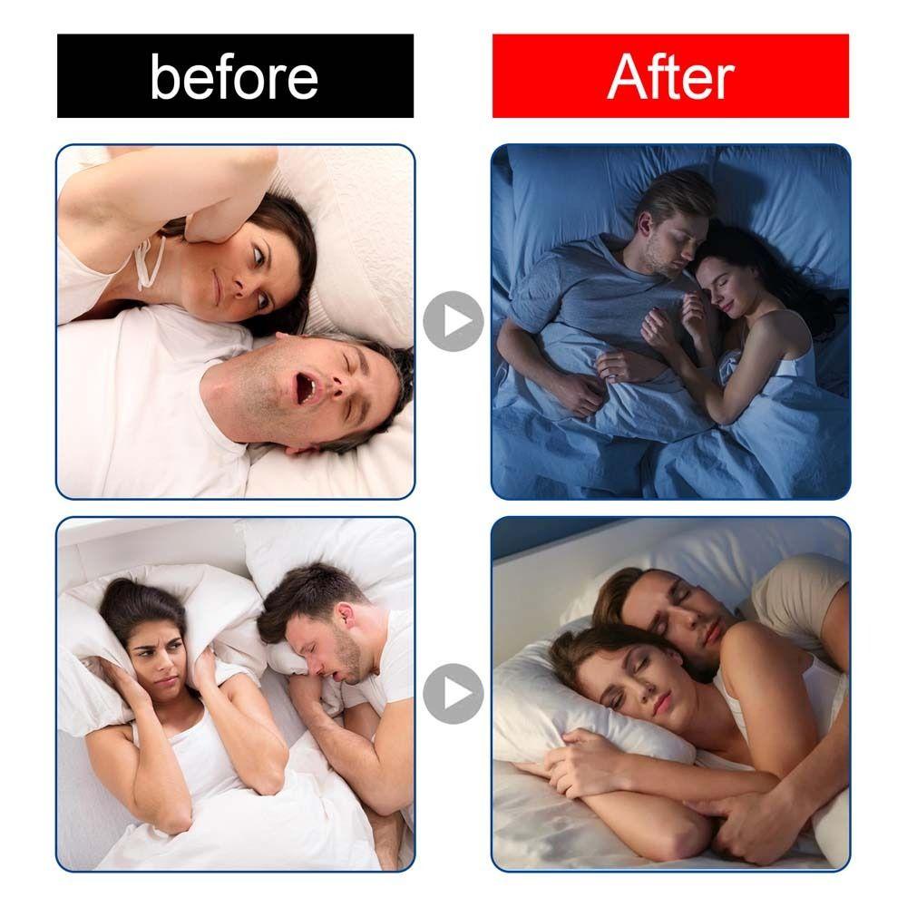 Bộ 60 Miếng Dán Mũi Chống Ngáy Khi Ngủ Tiện Dụng