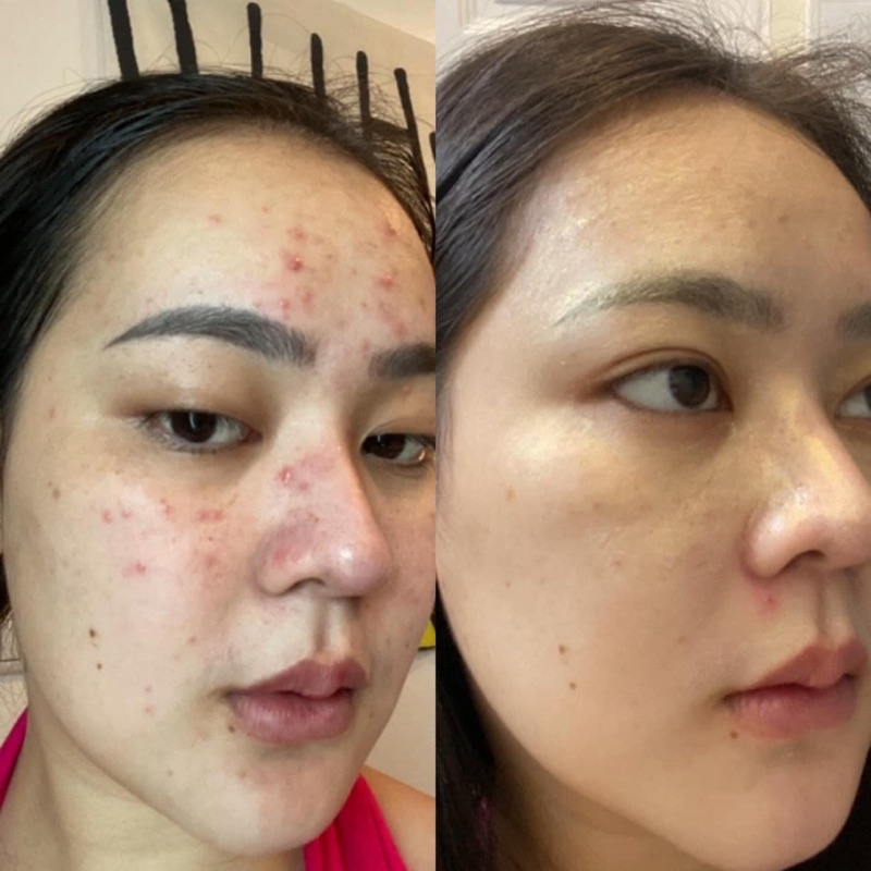 Mặt nạ hoa hồng 🌹 Golden rose mask Mặt nạ ngủ làm sáng da , giảm mụn , làm cho da đều màu 5g