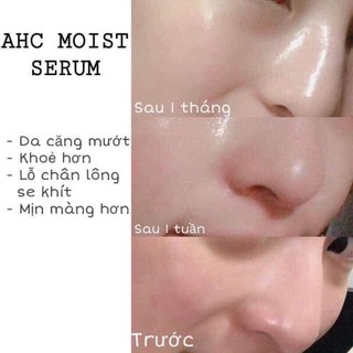 Tinh chất AHC Capture Solution Signature 50ml