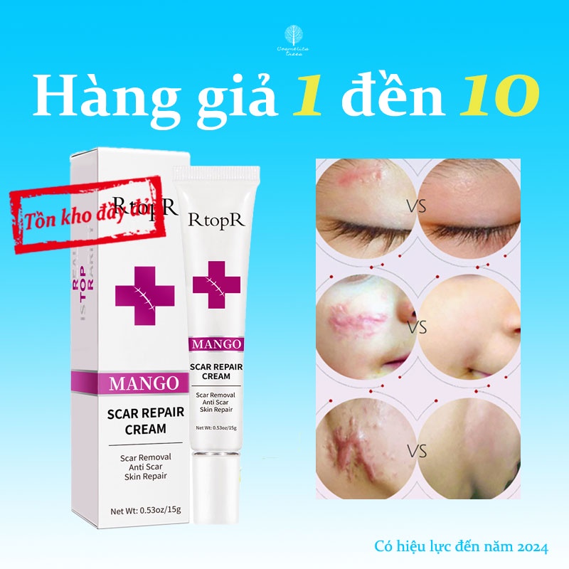 Kem dưỡng da RtopR làm mờ sẹo,Phục hồi vết sẹo mổ đẻ sau phẫu thuật,làm mờ sẹo mụn,Sửa chữa vết sẹo,15g
