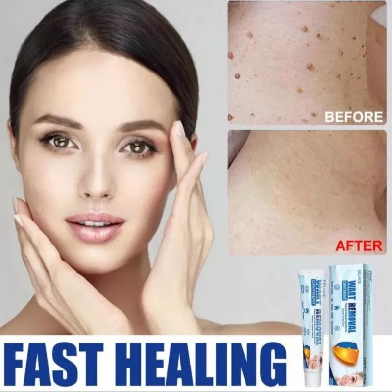 serum gel tẩy nốt ruồi xoá mụn,tàn nhang,mụn cóc,mụn thịt,mụn cơm tại nhà an toàn và ngừa sẹo lồi thâm...