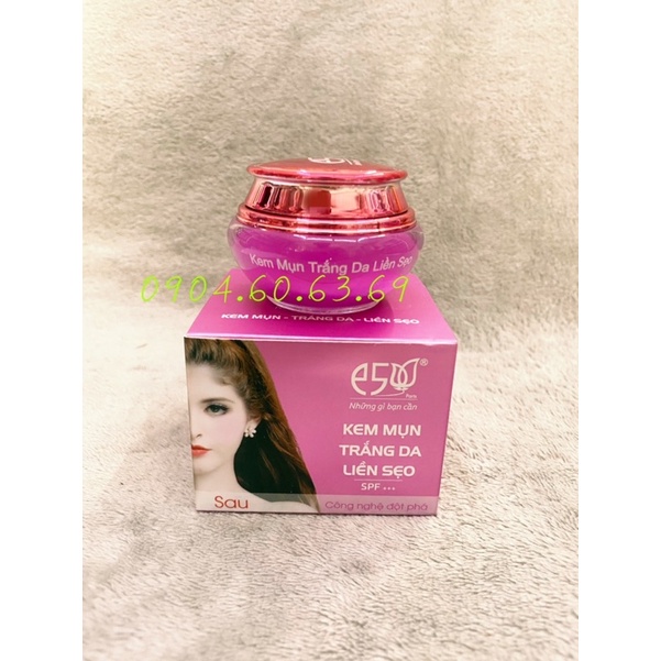 Kem E5 18g Mụn Trắng Da- Liền Sẹo