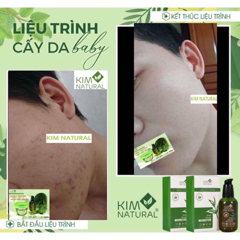 TINH CHẤT TRÀ XANH THƯỜNG KIMNATURAL