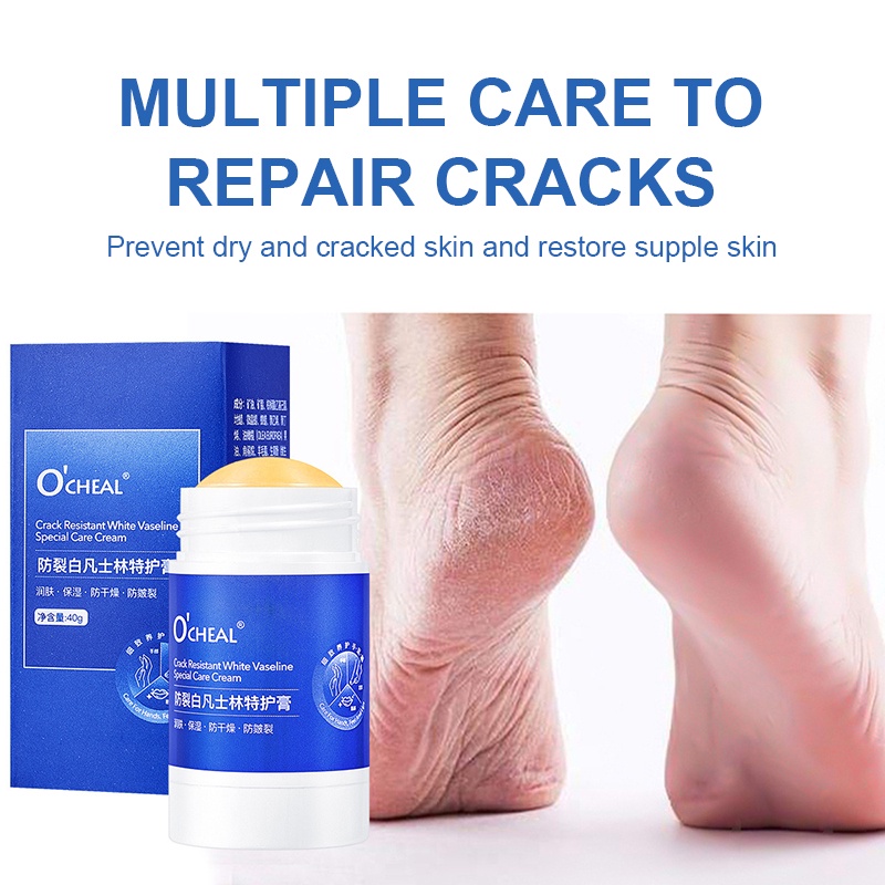 LEWEDO Vaseline Kem Dưỡng Chân Mùa Đông Gót Chân Chống Khô Dưỡng Ẩm Chống Đóng Băng Tay