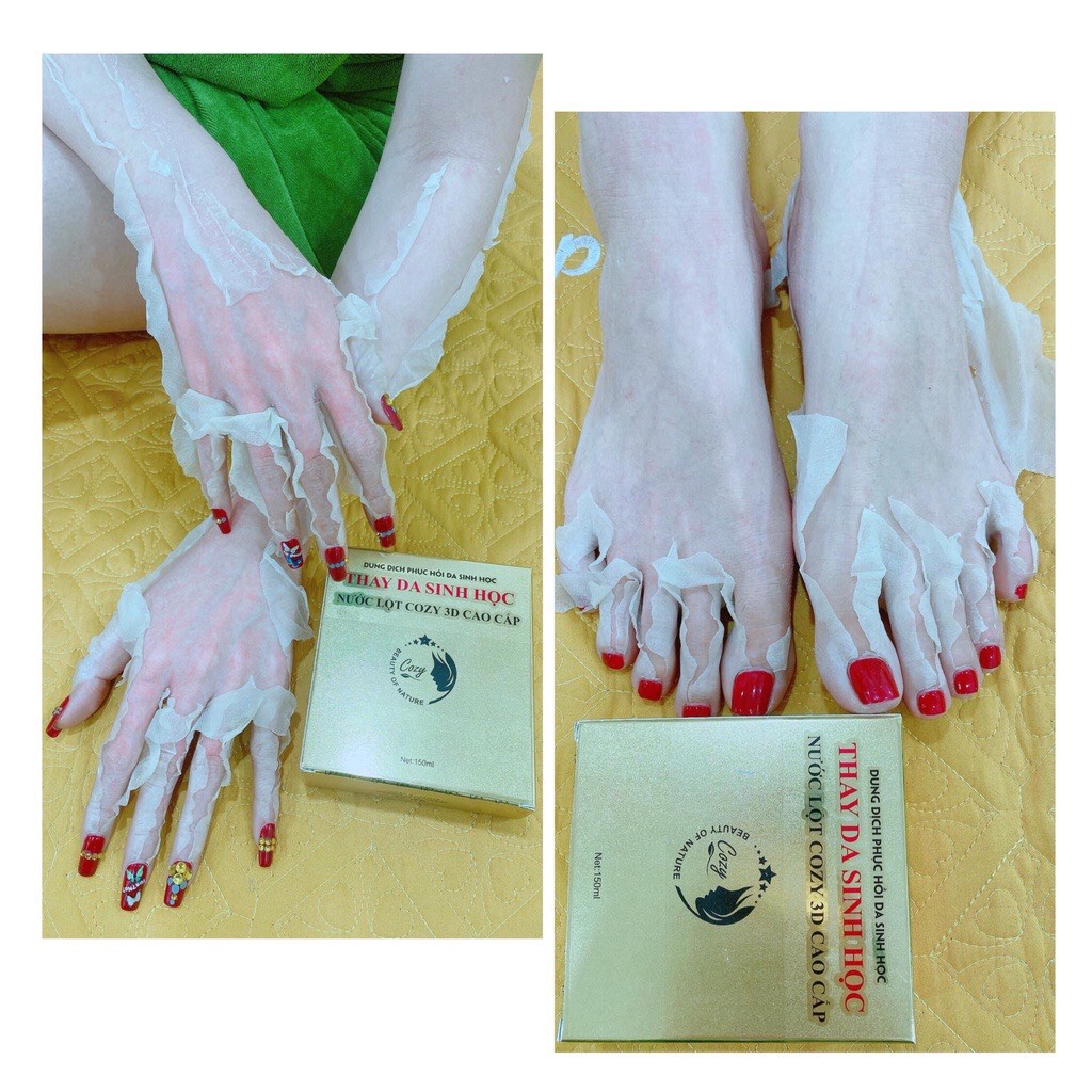 Lột da sinh học COZY 3D - Thay da body - phục hồi tái tạo da - nước lột peel da toàn thân