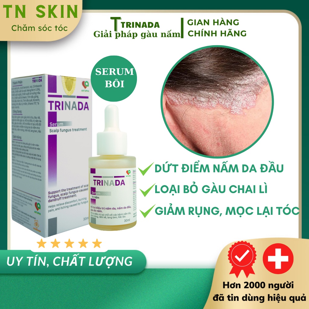 Nấm da đầu, sạch gàu ngứa loại bỏ tận gốc nấm da đầu lâu năm hiệu quả không tái phát, ngăn rụng tóc serum Trinada
