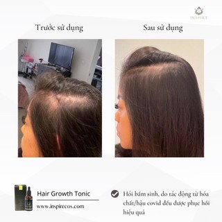 TINH CHẤT MỌC TÓC, LÀM PHỒNG CHÂN TÓC 𝐈𝐍𝐒𝐏𝐈𝐑𝐄 𝐇𝐀𝐈𝐑 𝐆𝐑𝐎𝐖𝐓𝐇 𝐓𝐎𝐍𝐈𝐂