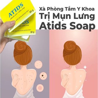 Xà phòng mụn lưng ATIDS SOAP 80g