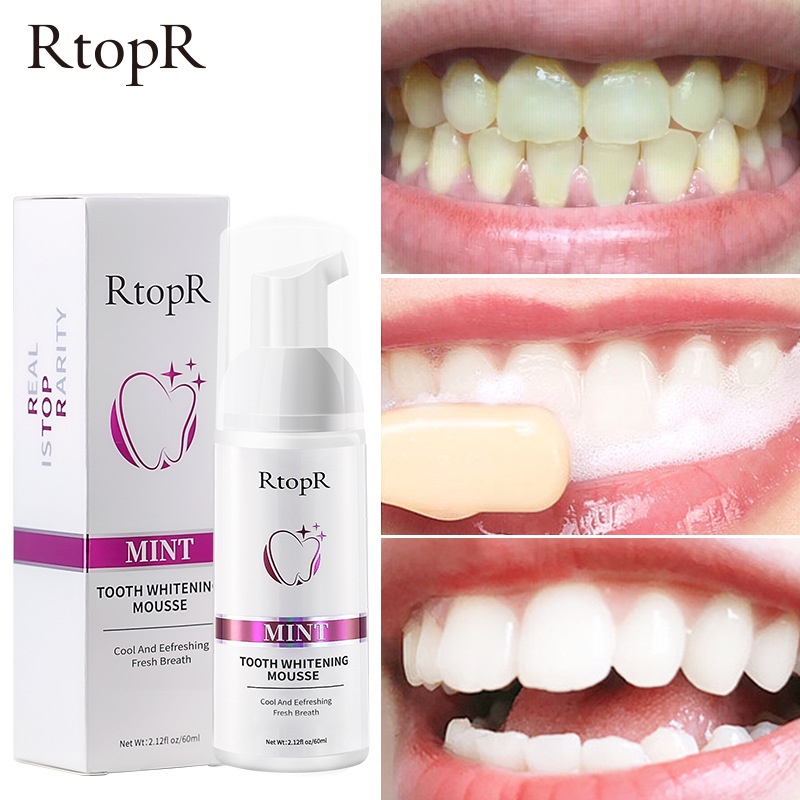 🦋giảm giá🦋Kem Làm Trắng Răng RtopR Mint tooth whitening 60ml Làm trắng răng, hơi thở tươi mát, giảm mảng bám răng