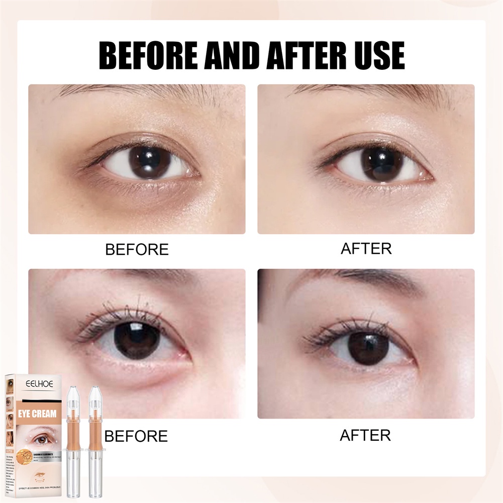 Kem Dưỡng Mắt Eelhoe Nâng Mắt, Xóa Nếp Nhăn, Bổ Sung Nước, Khử Muối Quầng Thâm, Nếp Nhăn, Đường Kẻ Mắt, Tinh Dầu Mắt-Ampere