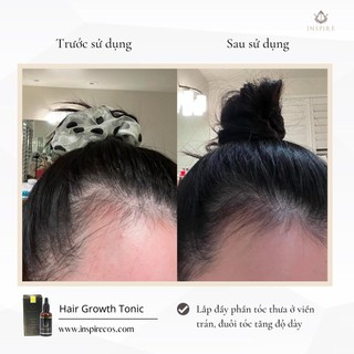 TINH CHẤT MỌC TÓC, LÀM PHỒNG CHÂN TÓC 𝐈𝐍𝐒𝐏𝐈𝐑𝐄 𝐇𝐀𝐈𝐑 𝐆𝐑𝐎𝐖𝐓𝐇 𝐓𝐎𝐍𝐈𝐂