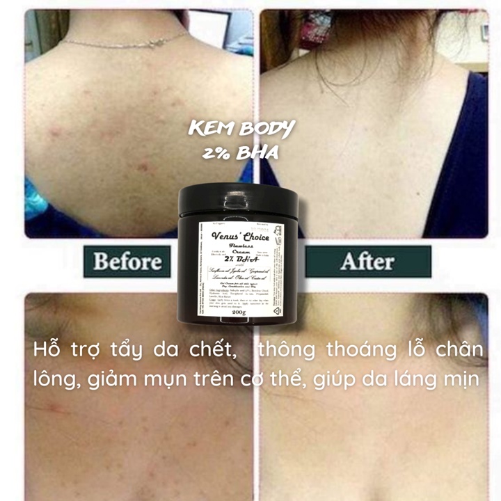 Kem Body dưỡng thể 2% BHA và Niacinamide giúp trắng sáng da, mịn da và giảm bít lỗ chân lông