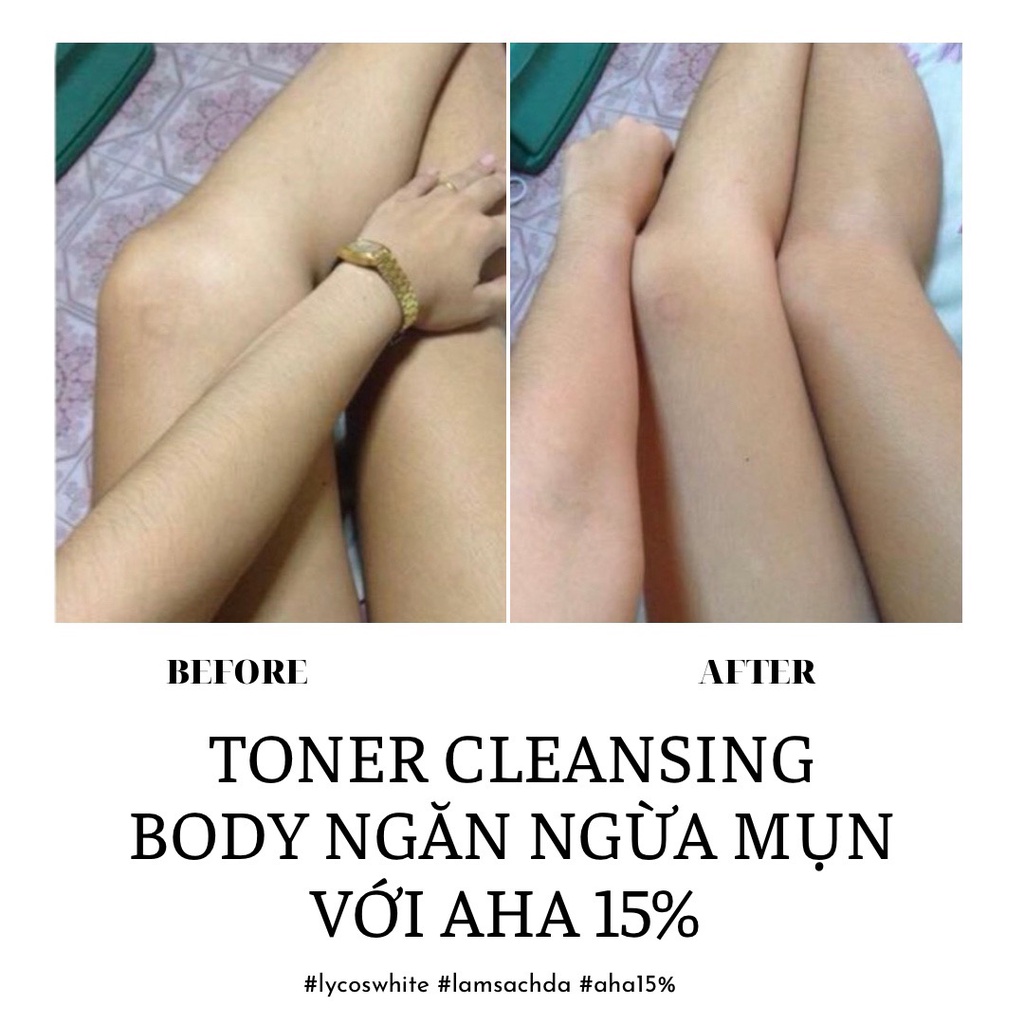 Toner Hyaluronic Acid 15% AHA Cleansing Làm Sạch Body Lycos White