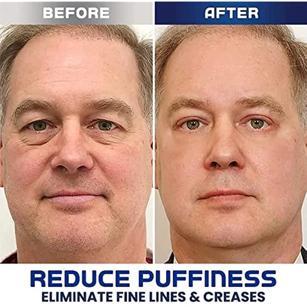 Kem Dưỡng Ẩm Chống Lão Hóa Xóa Quầng Thâm Và Bọng Mắt Cho Nam