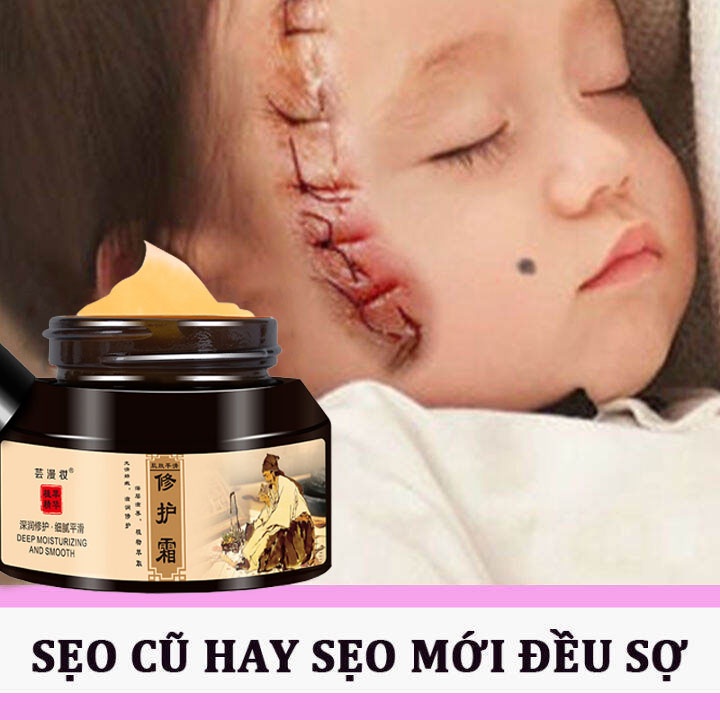 Kem xóa Sẹo Thâm Kem sẹo 50g Xóa sẹo thâm rạn da hiệu quả mờ thâm bỏng thương phẫu thuật thuốc sẹo