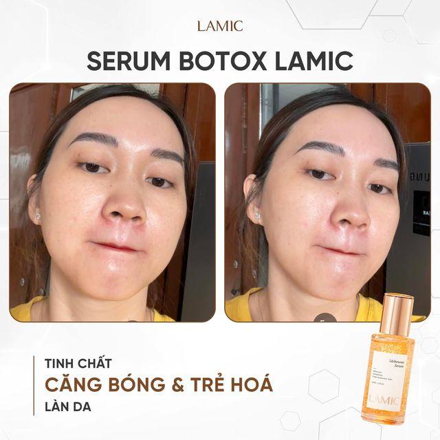 Serum Botox Dưỡng Da LAMIC