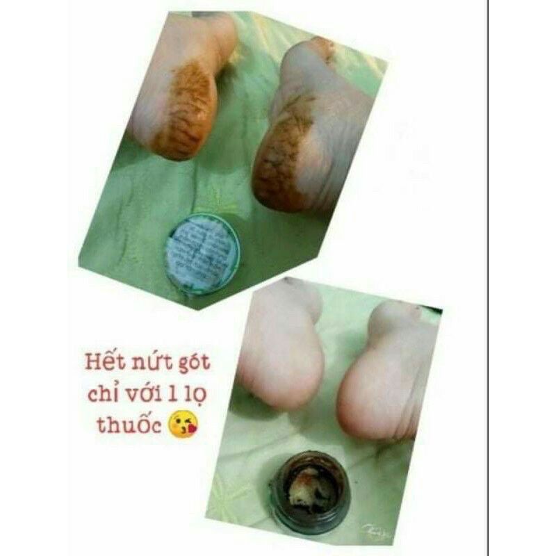 THẢO MỘC BÔI DA