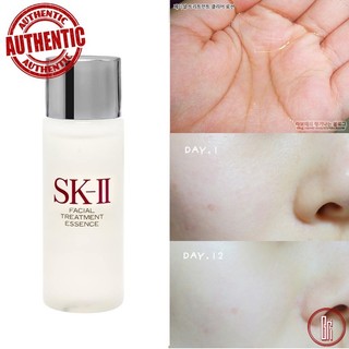 Nước thần Skii essence 30ml