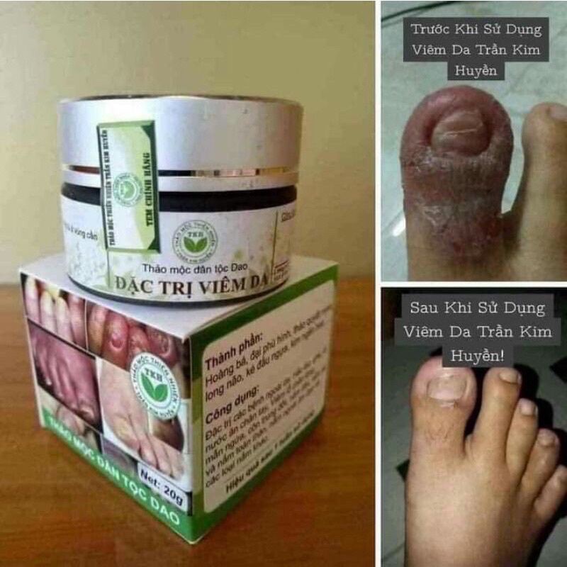 THẢO MỘC BÔI DA