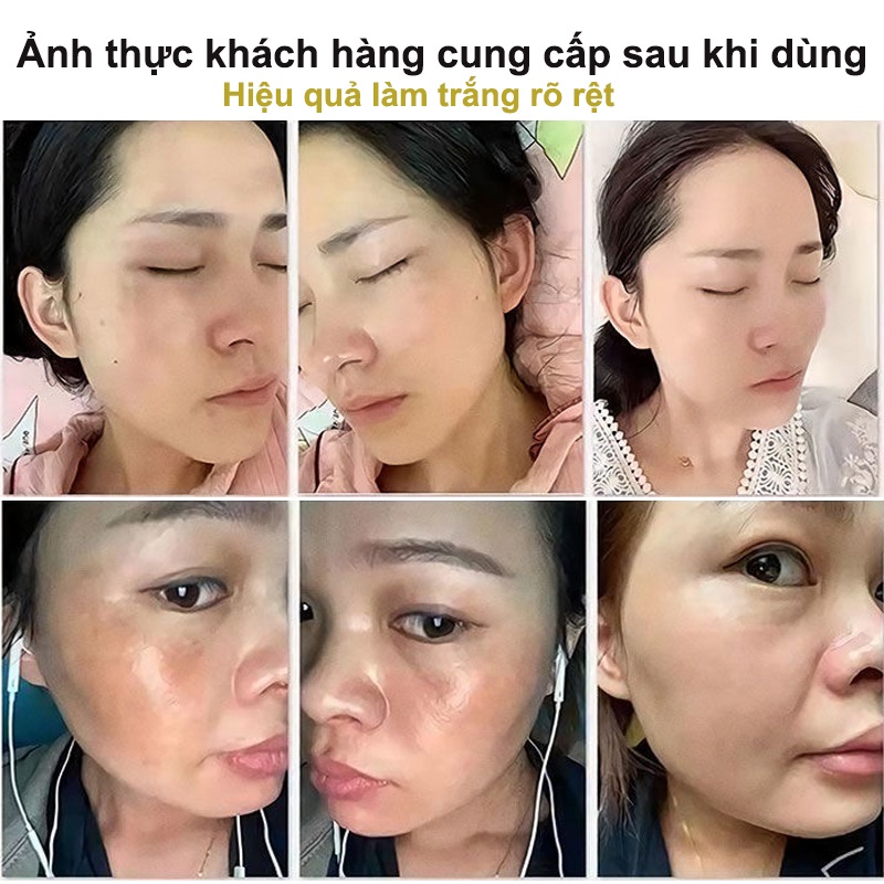 Tinh chất làm trắng sạch tàn nhang 100ml Kem trắng da và xóa tàn nhang, Hiệu quả làm mờ thâm nám tàn nhan, kem thâm nám