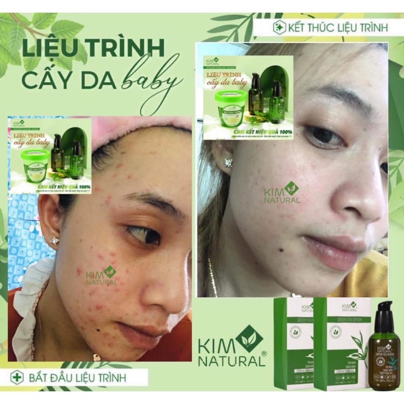 TINH CHẤT TRÀ XANH THƯỜNG KIMNATURAL