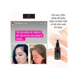 TINH CHẤT MỌC TÓC, LÀM PHỒNG CHÂN TÓC 𝐈𝐍𝐒𝐏𝐈𝐑𝐄 𝐇𝐀𝐈𝐑 𝐆𝐑𝐎𝐖𝐓𝐇 𝐓𝐎𝐍𝐈𝐂