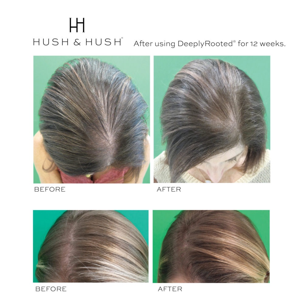 Viên uống mọc tóc, phục hồi tóc gãy rụng Hush & Hush Deeply Rooted 120 viên