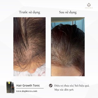 TINH CHẤT MỌC TÓC, LÀM PHỒNG CHÂN TÓC 𝐈𝐍𝐒𝐏𝐈𝐑𝐄 𝐇𝐀𝐈𝐑 𝐆𝐑𝐎𝐖𝐓𝐇 𝐓𝐎𝐍𝐈𝐂