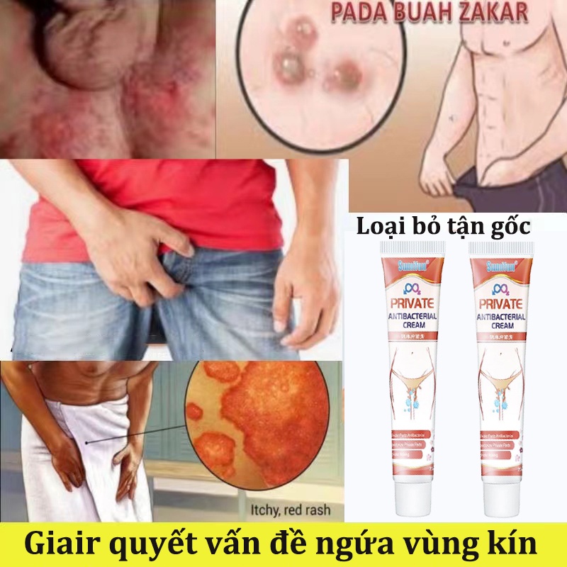 giảm ngứa kem chống chàm eczema giảm ngứa thảo dược kháng khuẩn 20g