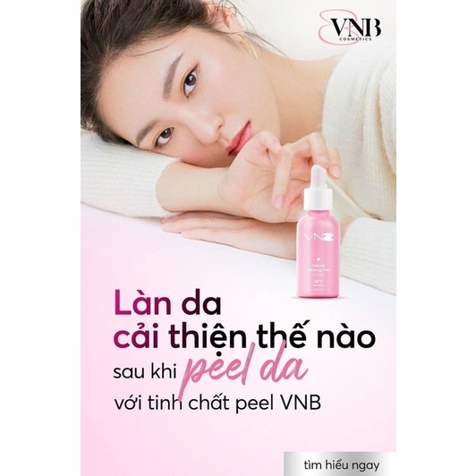 Peel da VNB