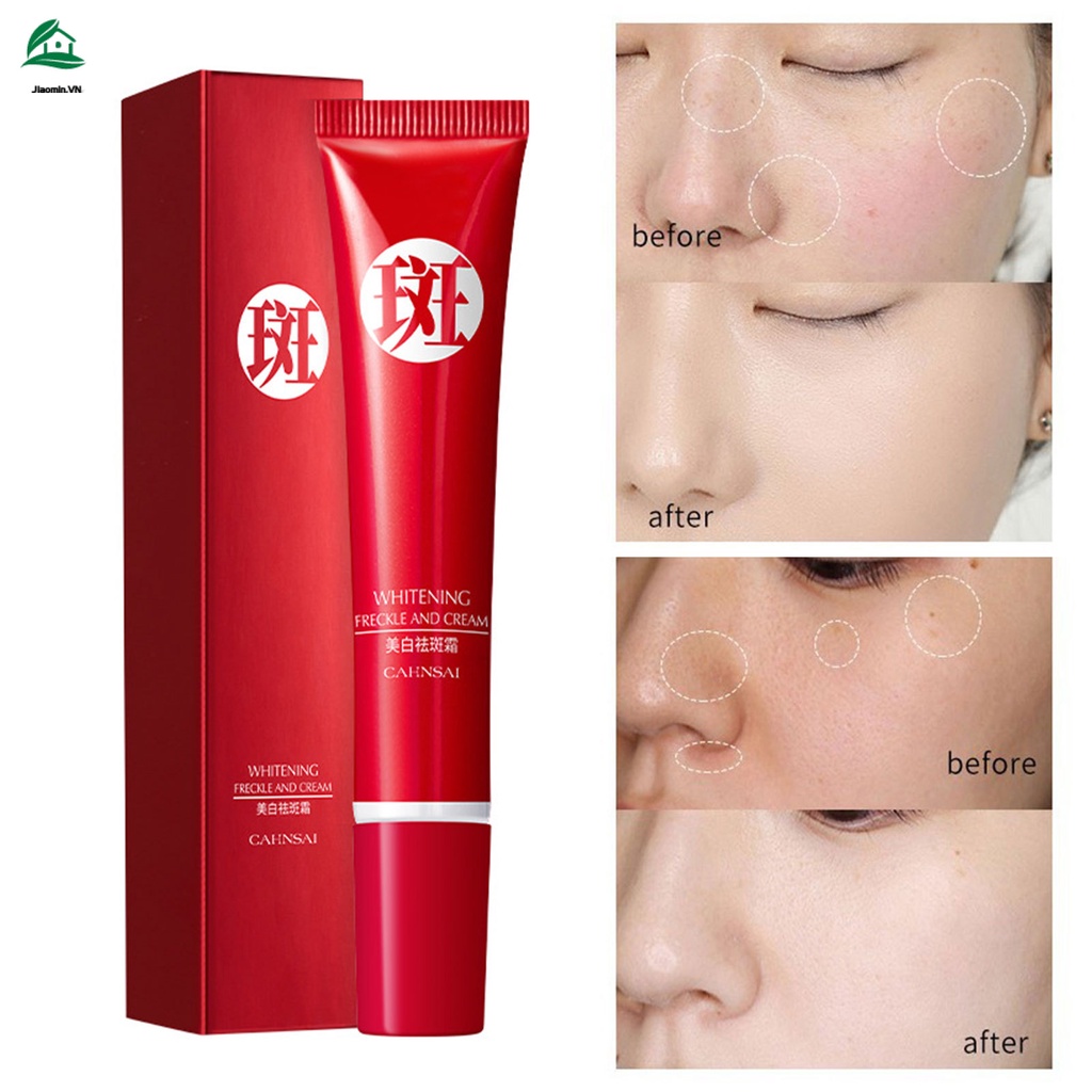 Kem Làm Trắng Xóa Đốm Nâu Và Đốm Nâu Trên Da 20g