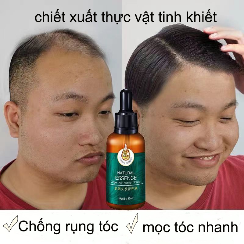 mọc tóc tinh dầu mọc tóc Tinh chất gừng cho tóc Giúp tóc mọc dày hơn giảm rụng tóc 30MLDung dịch dinh dưỡng mọc tóc giú