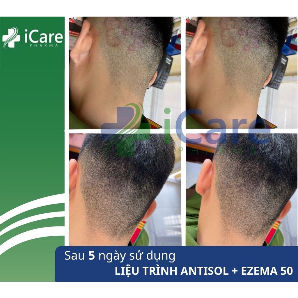 Bộ Sản Phẩm iCare Pharma Dermato, Ezema 50, Dầu Gội Sạch Gàu Antisol | Hỗ Trợ Trị Gàu Ngứa, Nấm Da Đầu Lâu Nă